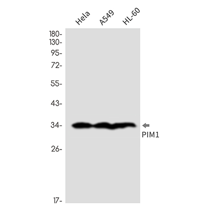 PIM1  (3I7) Rabbit Monoclonal Antibody | 兔单抗 | EnkiLife恩玑生命