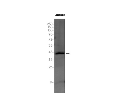 PIM2 (17I7) Rabbit Monoclonal Antibody | 兔单抗 | EnkiLife恩玑生命