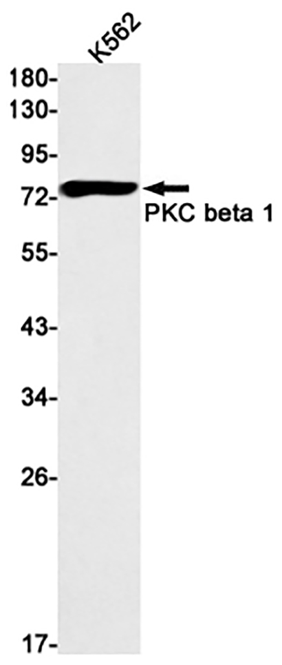 PKC beta 2  (12R10) Rabbit Monoclonal Antibody | 兔单抗 | EnkiLife恩玑生命