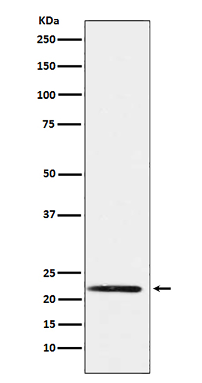 PMP22 (2M9) Rabbit Monoclonal Antibody | 兔单抗 | EnkiLife恩玑生命