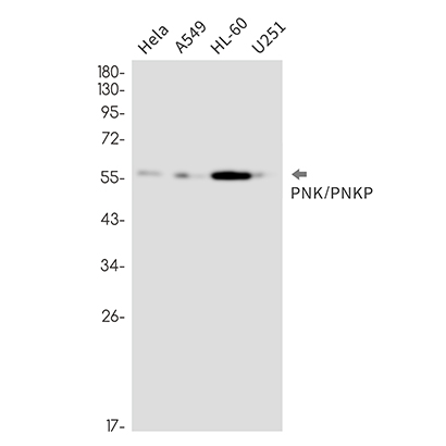 PNK / PNKP (12Y10) Rabbit Monoclonal Antibody | 兔单抗 | EnkiLife恩玑生命