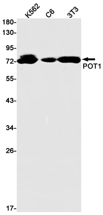 POT1 (19U2) Rabbit Monoclonal Antibody | 兔单抗 | EnkiLife恩玑生命