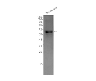PPAR gamma (19L6) Rabbit Monoclonal Antibody | 兔单抗 | EnkiLife恩玑生命