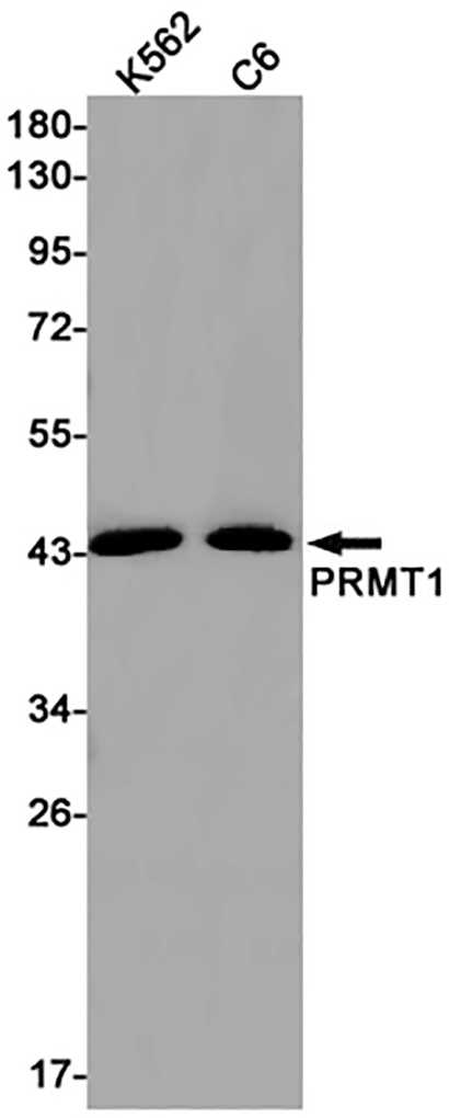 PRMT1 (2C19) Rabbit Monoclonal Antibody | 兔单抗 | EnkiLife恩玑生命