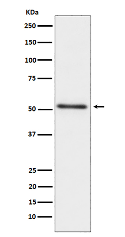 Prostatic Acid Phosphatase (14A5) Rabbit Monoclonal Antibody | 兔单抗 | EnkiLife恩玑生命