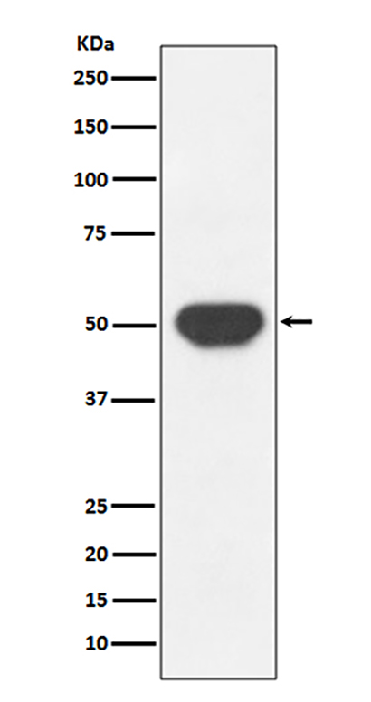 PTP1B (13P19) Rabbit Monoclonal Antibody | 兔单抗 | EnkiLife恩玑生命