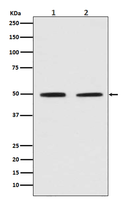 Pygopus 2 (14L2) Rabbit Monoclonal Antibody | 兔单抗 | EnkiLife恩玑生命