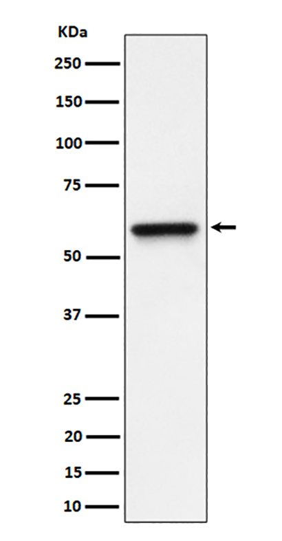 RGS6 (3A18) Rabbit Monoclonal Antibody | 兔单抗 | EnkiLife恩玑生命