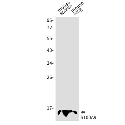 S100 alpha9 (13Z5) Rabbit Monoclonal Antibody | 兔单抗 | EnkiLife恩玑生命