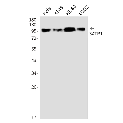 SATB1 (11U13) Rabbit Monoclonal Antibody | 兔单抗 | EnkiLife恩玑生命
