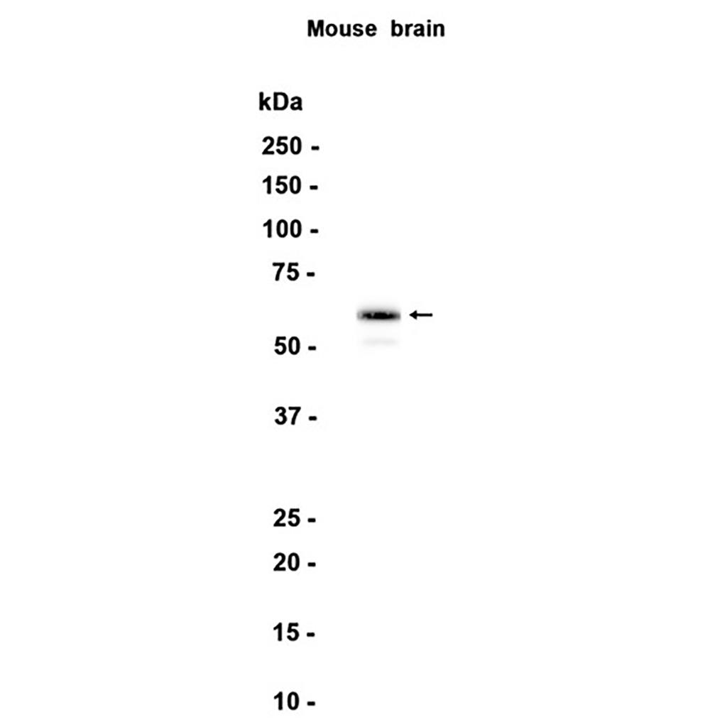 STXBP1 (6W16) Rabbit Monoclonal Antibody | 兔单抗 | EnkiLife恩玑生命