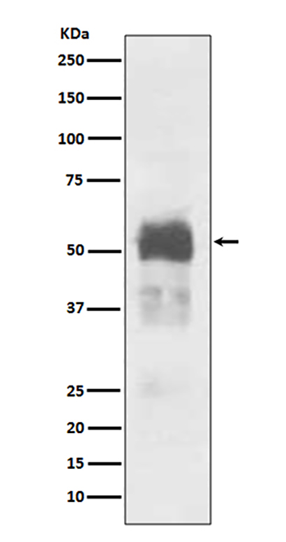 Tau (5W5) Rabbit Monoclonal Antibody | 兔单抗 | EnkiLife恩玑生命