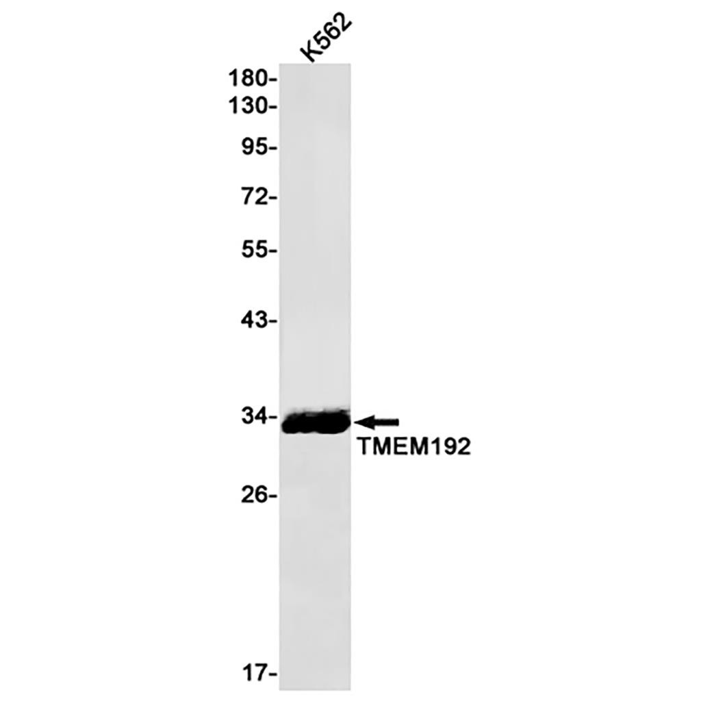 TMEM192 (10L14) Rabbit Monoclonal Antibody | 兔单抗 | EnkiLife恩玑生命