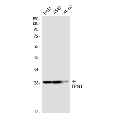 TPMT (3H2) Rabbit Monoclonal Antibody | 兔单抗 | EnkiLife恩玑生命