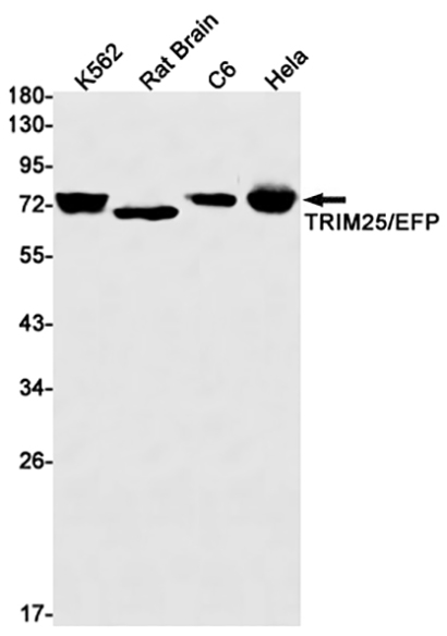 TRIM25 (1S16) Rabbit Monoclonal Antibody | 兔单抗 | EnkiLife恩玑生命