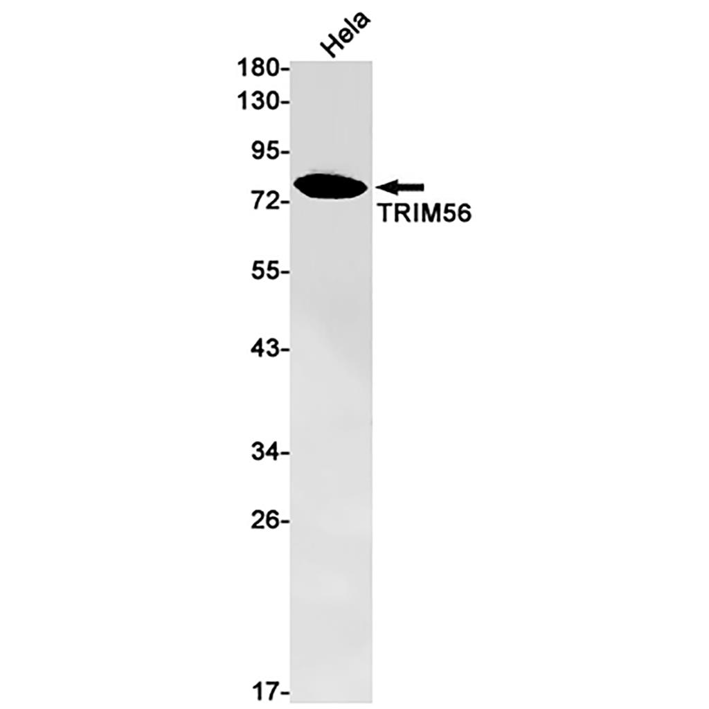 TRIM56 (5Y14) Rabbit Monoclonal Antibody | 兔单抗 | EnkiLife恩玑生命