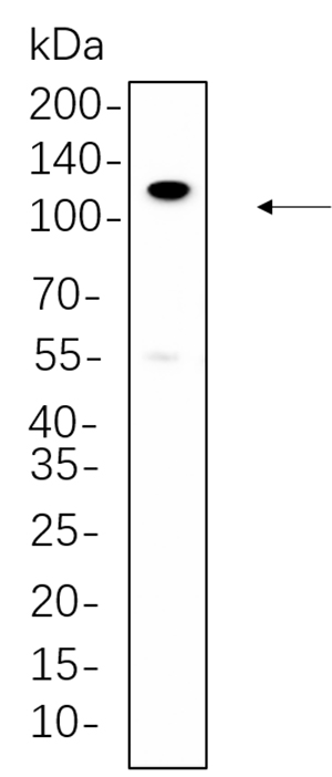PI3-Kinase p110 β Rabbit Monoclonal antibody | 兔单抗 | EnkiLife恩玑生命