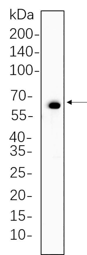 Paxillin (Phospho Tyr118) Rabbit Monoclonal antibody | 兔单抗 | EnkiLife恩玑生命