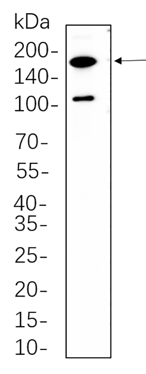 Rictor Rabbit Monoclonal antibody | 兔单抗 | EnkiLife恩玑生命