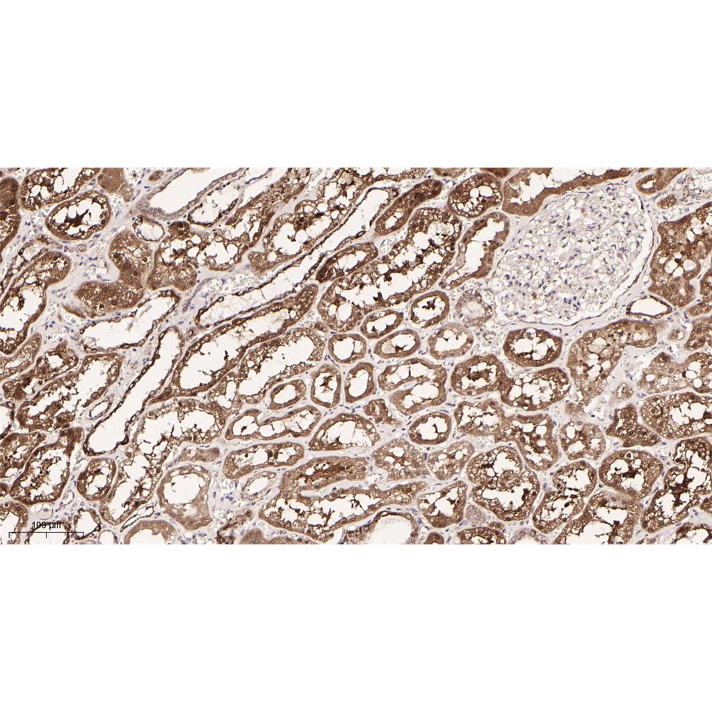 Pyruvate Dehydrogenase E1 α Rabbit Monoclonal antibody | 兔单抗 | EnkiLife恩玑生命