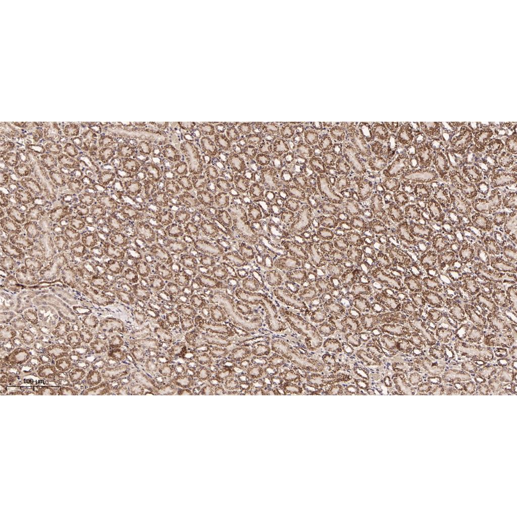 Pyruvate Dehydrogenase E1 α Rabbit Monoclonal antibody | 兔单抗 | EnkiLife恩玑生命