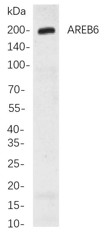 AREB6 Rabbit Monoclonal antibody | 兔单抗 | EnkiLife恩玑生命