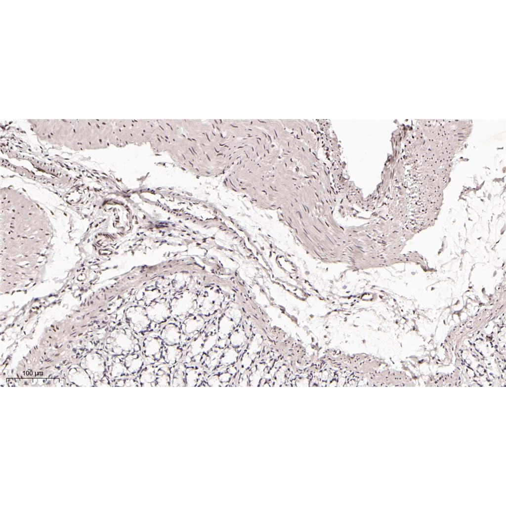 AREB6 Rabbit Monoclonal antibody | 兔单抗 | EnkiLife恩玑生命