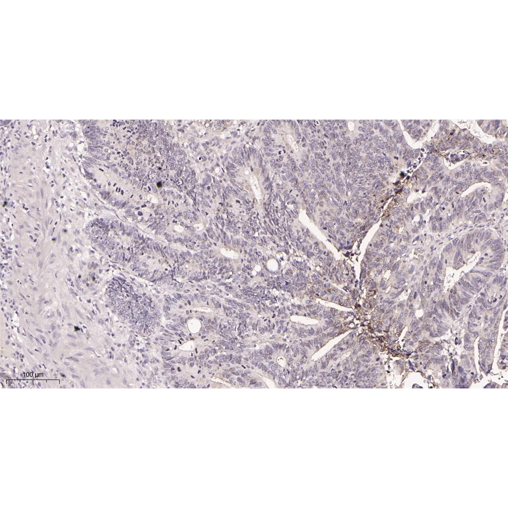 Carbonic Anhydrase 9 Rabbit Monoclonal antibody | 兔单抗 | EnkiLife恩玑生命