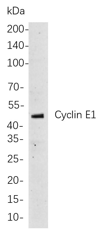 Cyclin E1 Rabbit Monoclonal antibody | 兔单抗 | EnkiLife恩玑生命