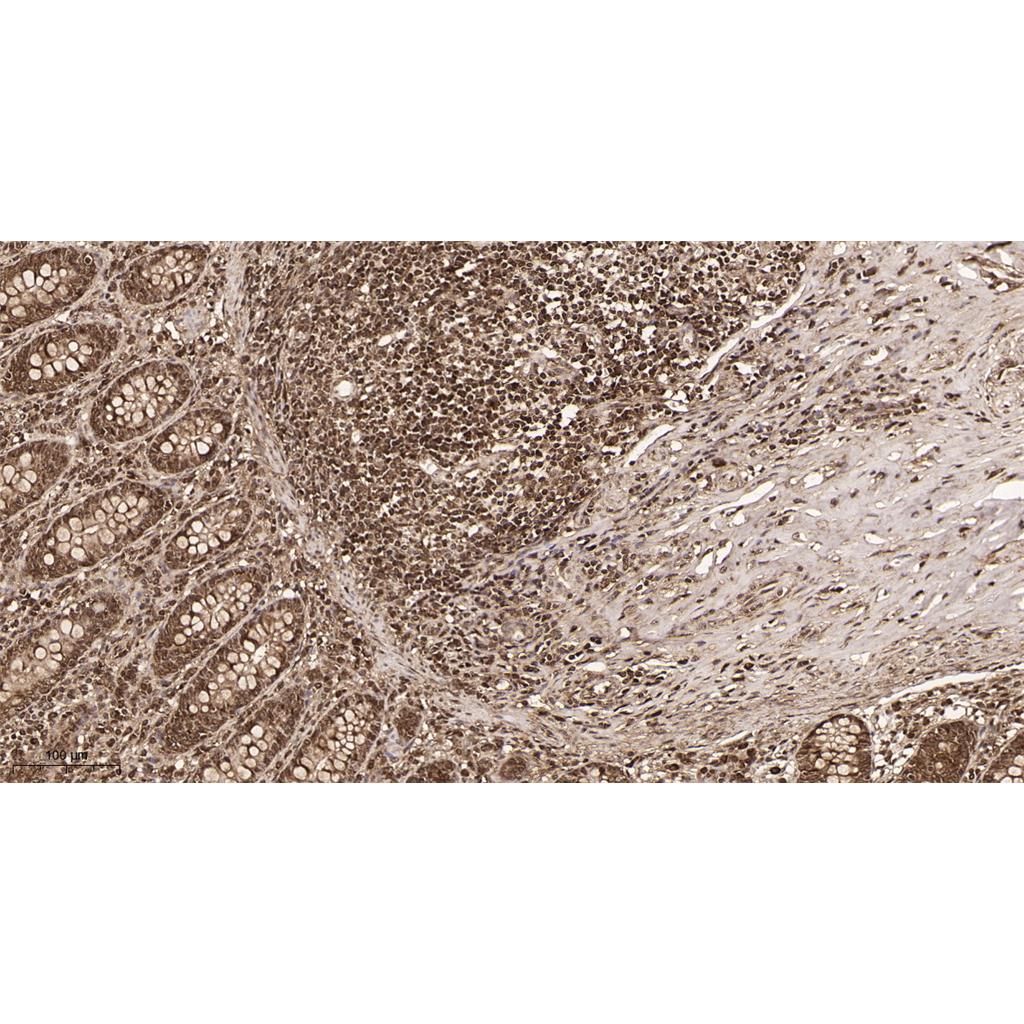 Lactate Dehydrogenase Isoenzyme V Rabbit Monoclonal antibody | 兔单抗 | EnkiLife恩玑生命