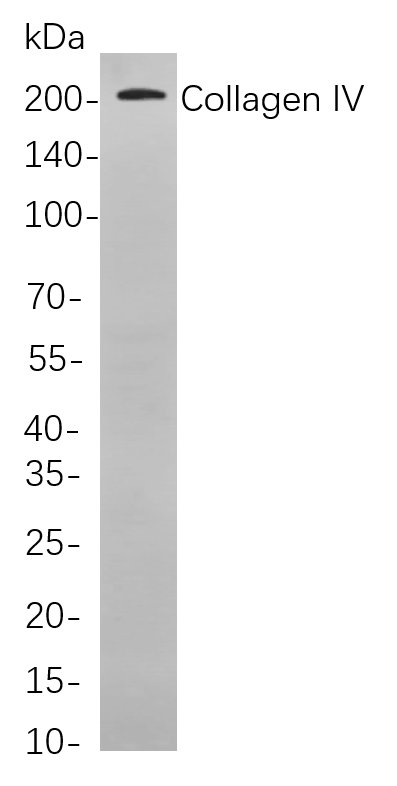 Collagen IV Rabbit Monoclonal antibody | 兔单抗 | EnkiLife恩玑生命
