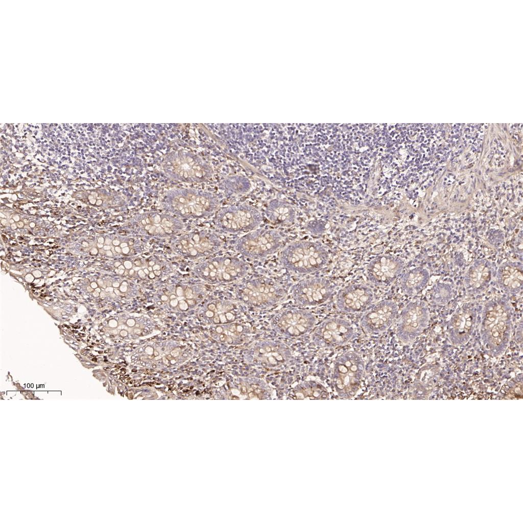 Collagen IV Rabbit Monoclonal antibody | 兔单抗 | EnkiLife恩玑生命