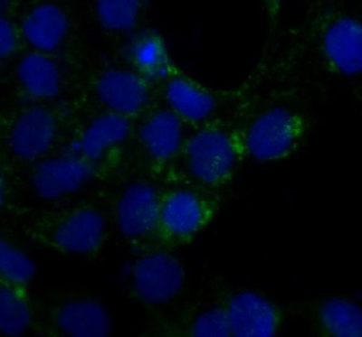 Caveolin 1 Rabbit Polyclonal Antibody | 兔多抗 | EnkiLife恩玑生命