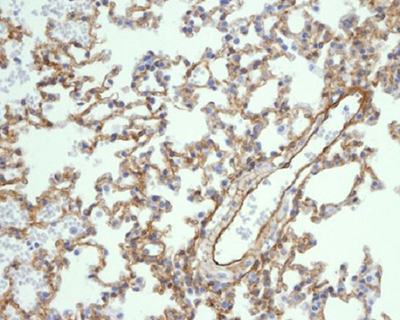 Caveolin 1 Rabbit Polyclonal Antibody | 兔多抗 | EnkiLife恩玑生命