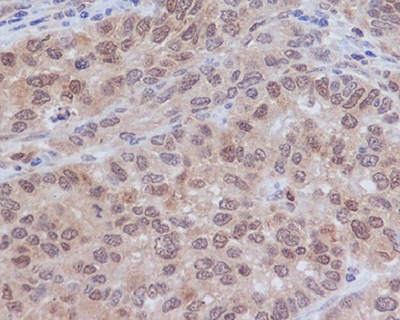 ERK2 Rabbit Polyclonal Antibody | 兔多抗 | EnkiLife恩玑生命