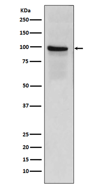 Thrombomodulin Rabbit Polyclonal Antibody | 兔多抗 | EnkiLife恩玑生命