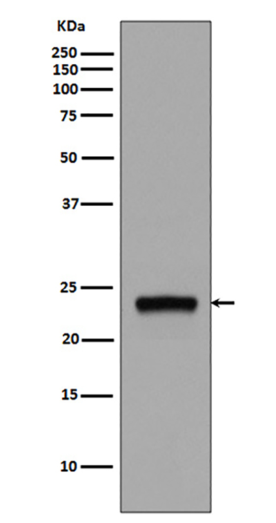 Rab5 Rabbit Polyclonal Antibody | 兔多抗 | EnkiLife恩玑生命