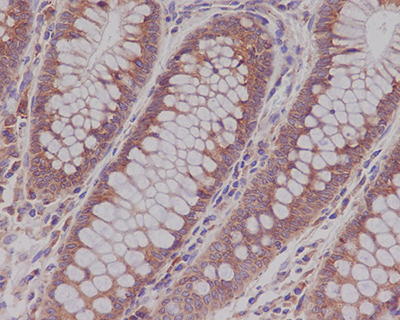Rab5 Rabbit Polyclonal Antibody | 兔多抗 | EnkiLife恩玑生命