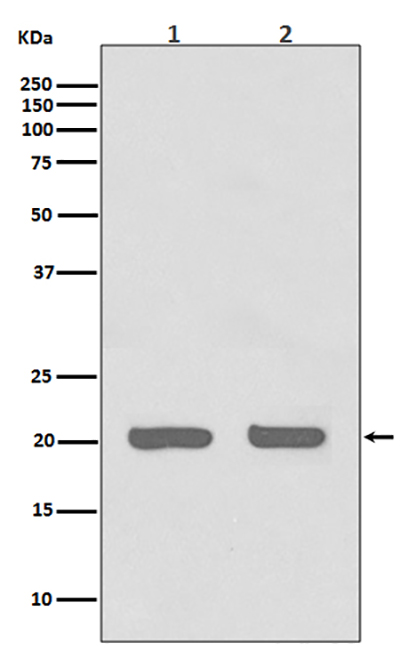 IL-1 Receptor Antagonist Protein Rabbit Polyclonal Antibody | 兔多抗 | EnkiLife恩玑生命