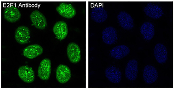 E2F1 Rabbit Polyclonal Antibody | 兔多抗 | EnkiLife恩玑生命