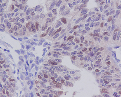 E2F1 Rabbit Polyclonal Antibody | 兔多抗 | EnkiLife恩玑生命
