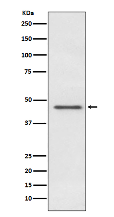 Pyruvate Dehydrogenase E1 alpha Rabbit Polyclonal Antibody | 兔多抗 | EnkiLife恩玑生命