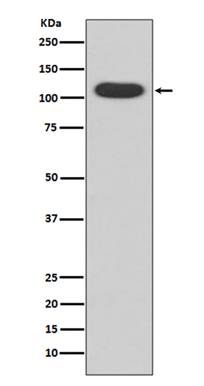 Aryl Hydrocarbon Receptor Rabbit Polyclonal Antibody | 兔多抗 | EnkiLife恩玑生命