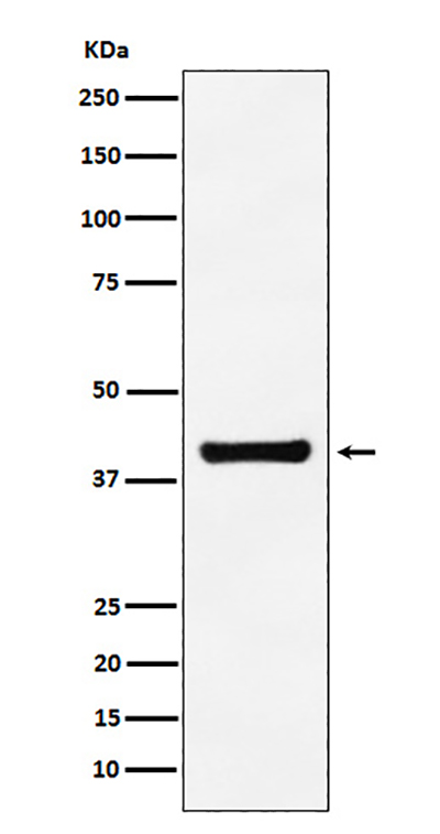 ALDOA Rabbit Polyclonal Antibody | 兔多抗 | EnkiLife恩玑生命