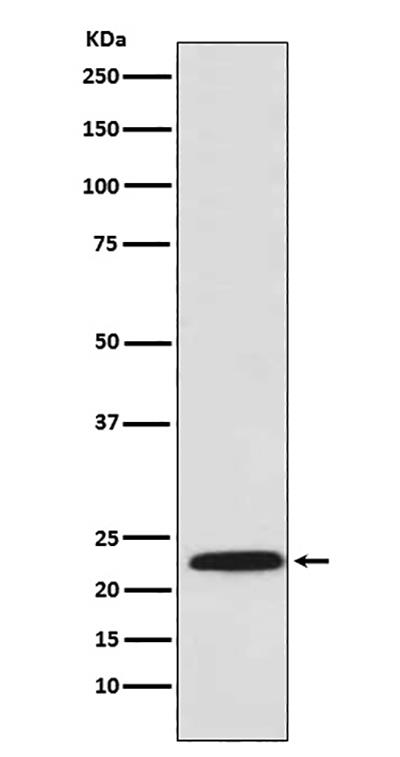 Proteasome beta 8 Rabbit Polyclonal Antibody | 兔多抗 | EnkiLife恩玑生命