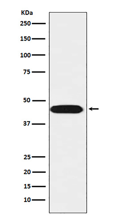 LIS1 Rabbit Polyclonal Antibody | 兔多抗 | EnkiLife恩玑生命