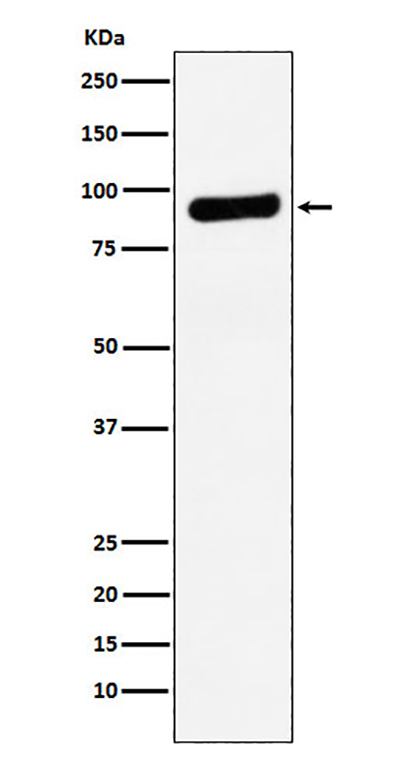 RRM1 Rabbit Polyclonal Antibody | 兔多抗 | EnkiLife恩玑生命