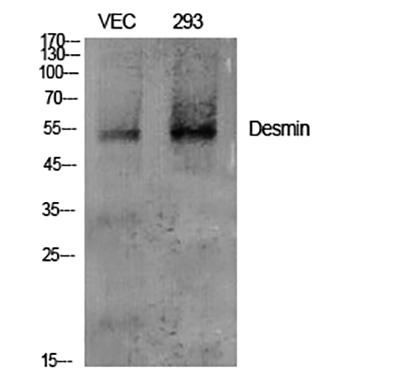 Desmin Rabbit Polyclonal Antibody | 兔多抗 | EnkiLife恩玑生命