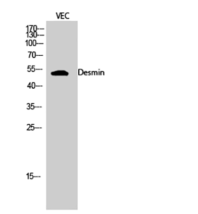 Desmin Rabbit Polyclonal Antibody | 兔多抗 | EnkiLife恩玑生命