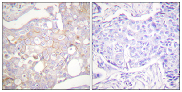 Claudin 4 Rabbit Polyclonal Antibody | 兔多抗 | EnkiLife恩玑生命